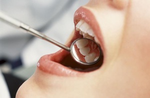 Prevenirea parodontitei acute