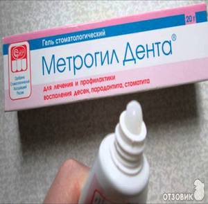 Metrogil în stomatologie