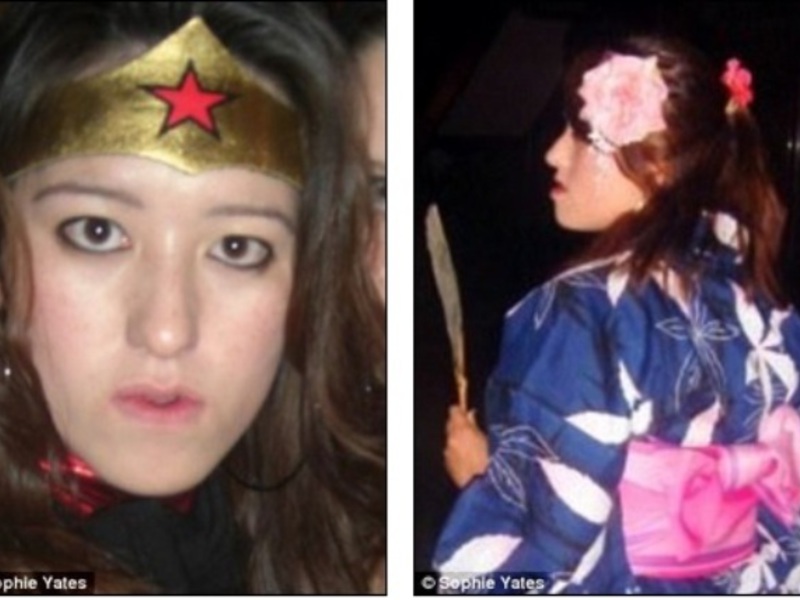 Corecția mușcăturii feminine O mușcătură grea a fetei